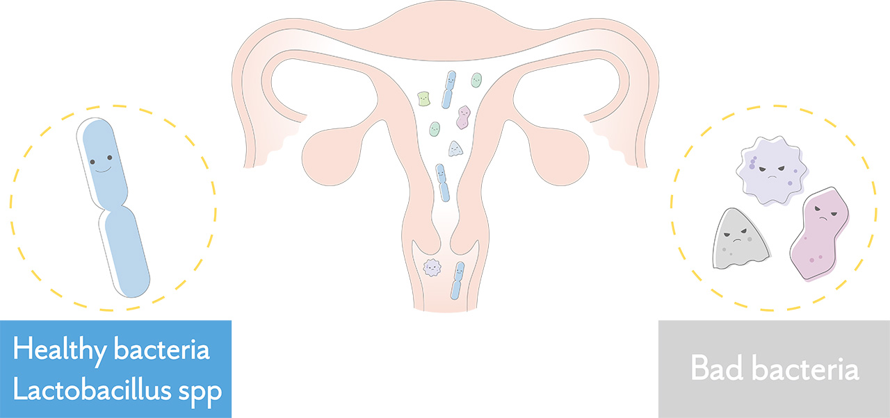 Bad bacteria Healthy bacteria Lactobacillus spp