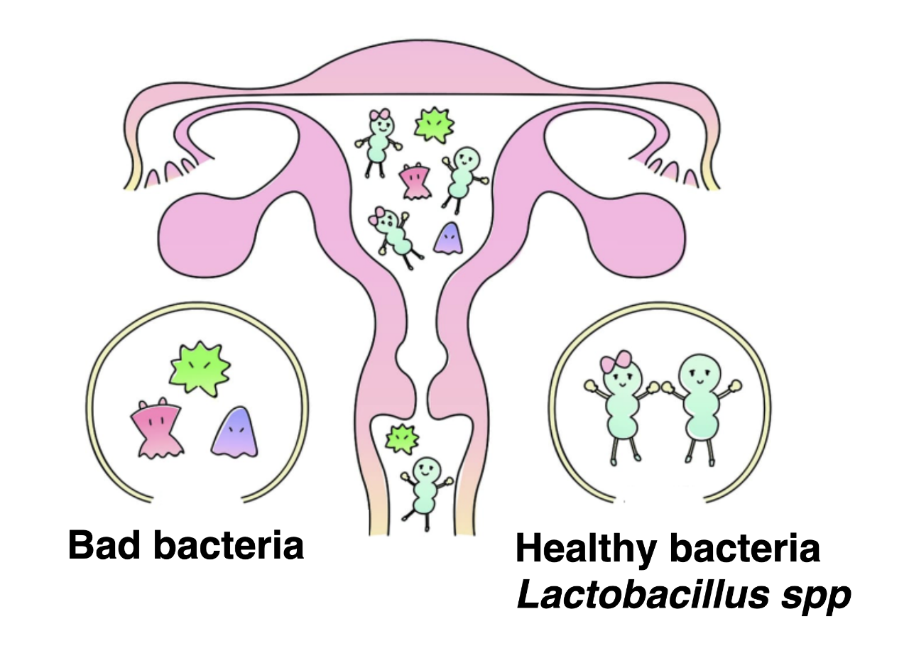 Bad bacteria Healthy bacteria Lactobacillus spp