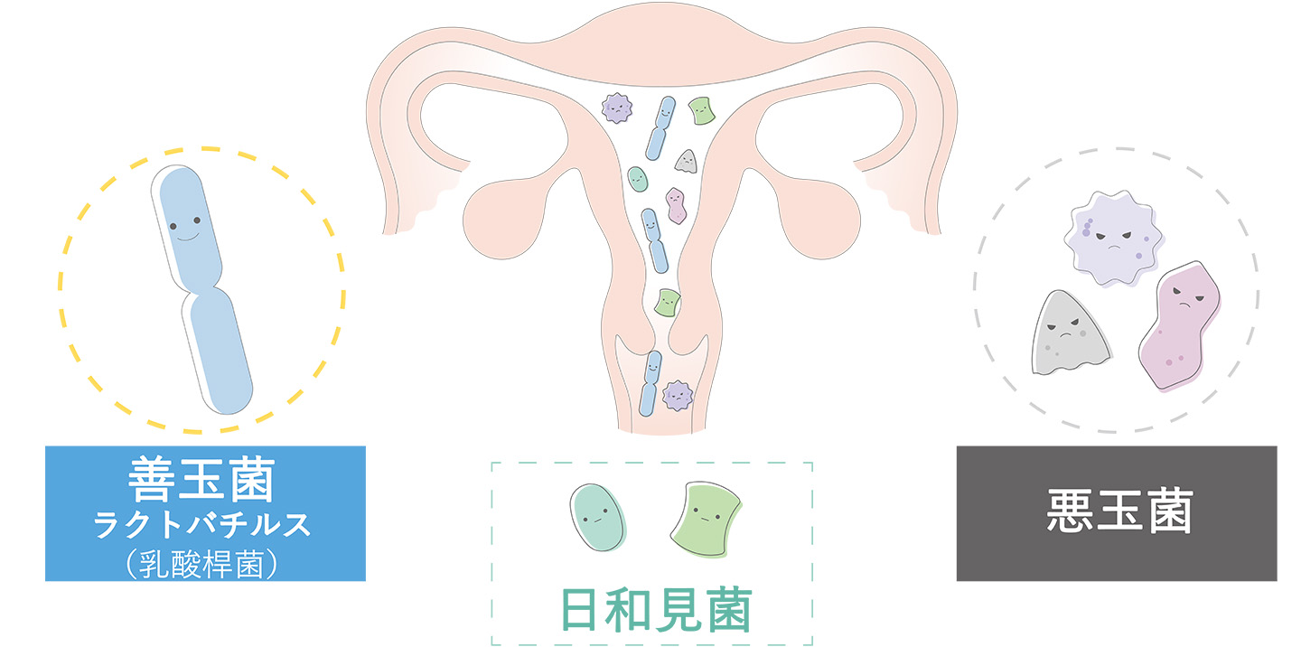 子宮内に存在する細菌
