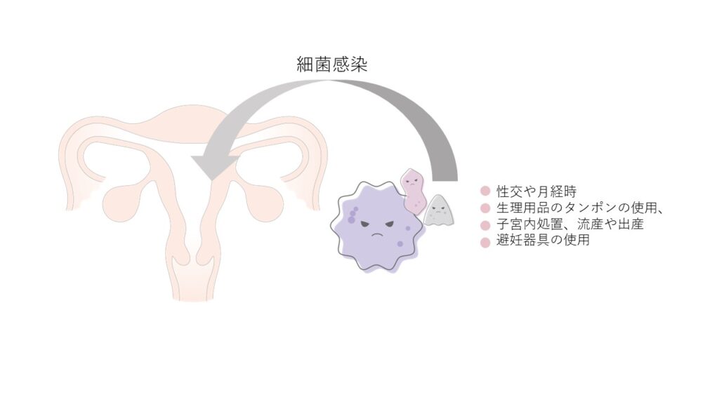 慢性子宮内膜炎の原因菌の感染経路