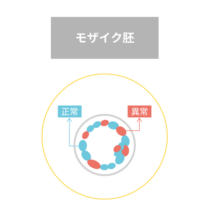 年齢別:体外受精の妊娠率と流産率~流産の兆候や流産しないためにできることとは | Varinos