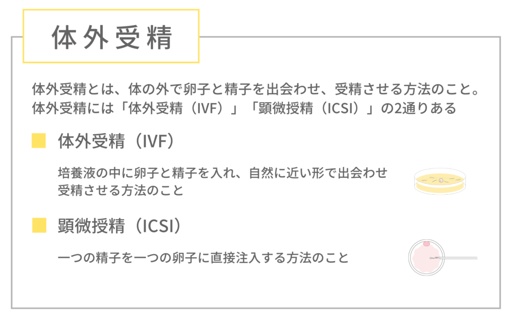 体外受精について