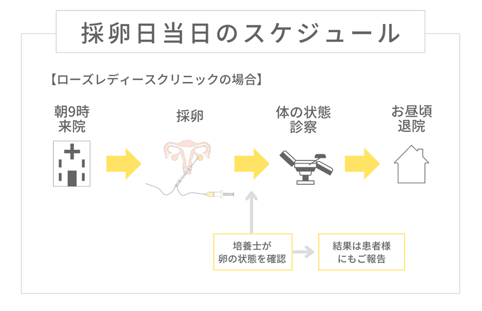 採卵当日のスケジュール