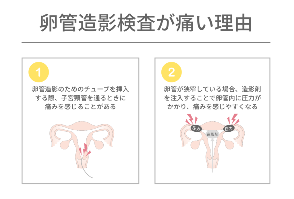 卵管造影検査で痛みを感じる理由