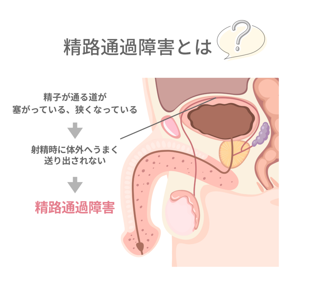 精路通過障害の図解
