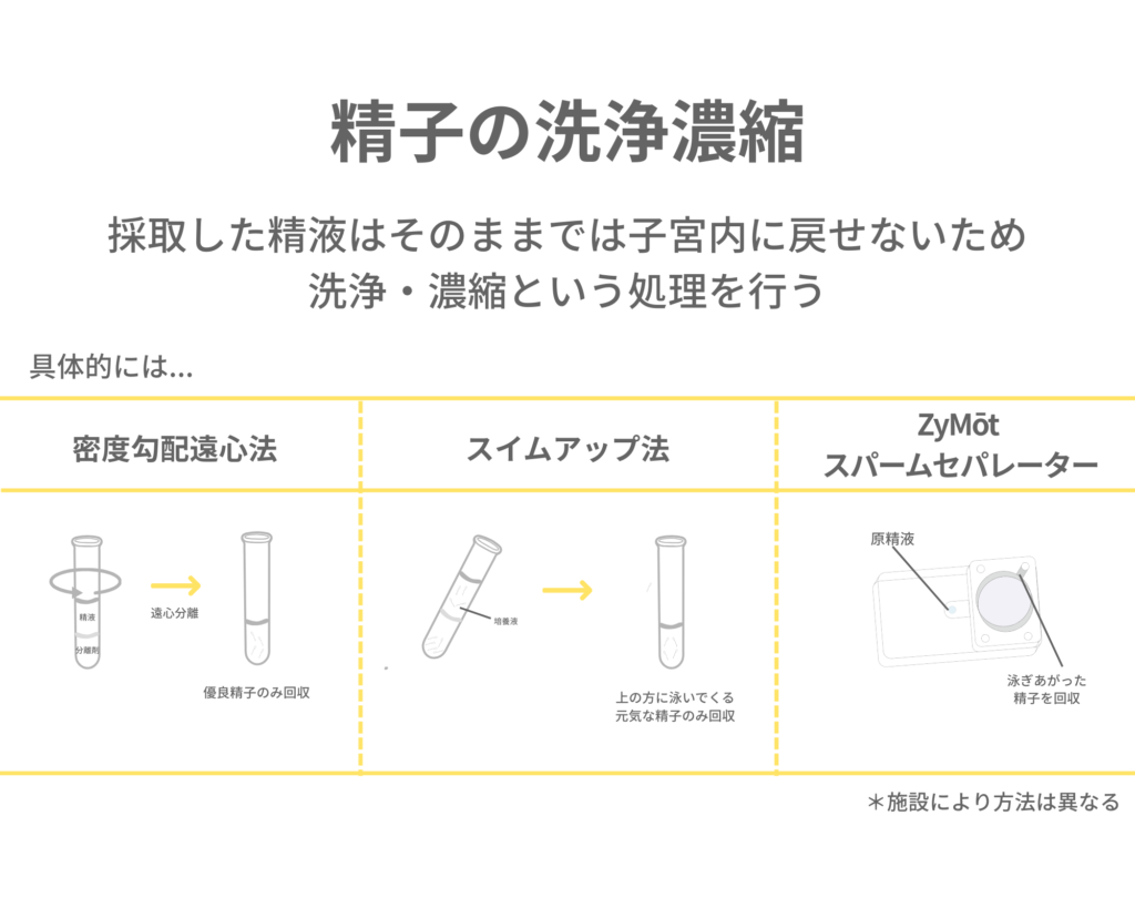 精子の洗浄濃縮方法についてイラストで解説