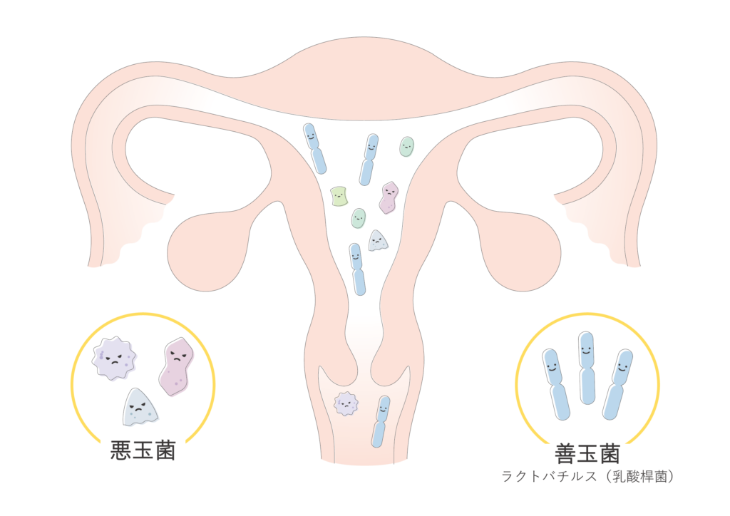 子宮内フローラとは多種多様な菌の集まりのこと