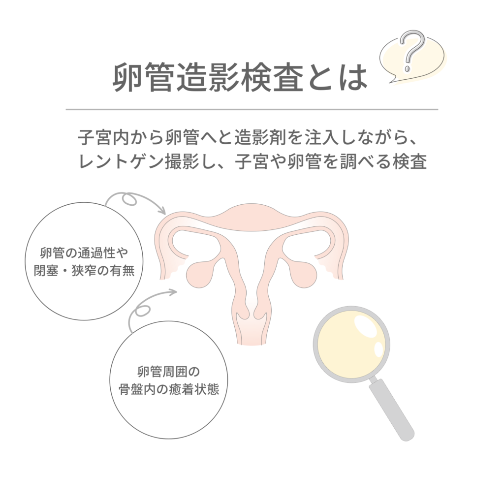 卵管造影検査の説明