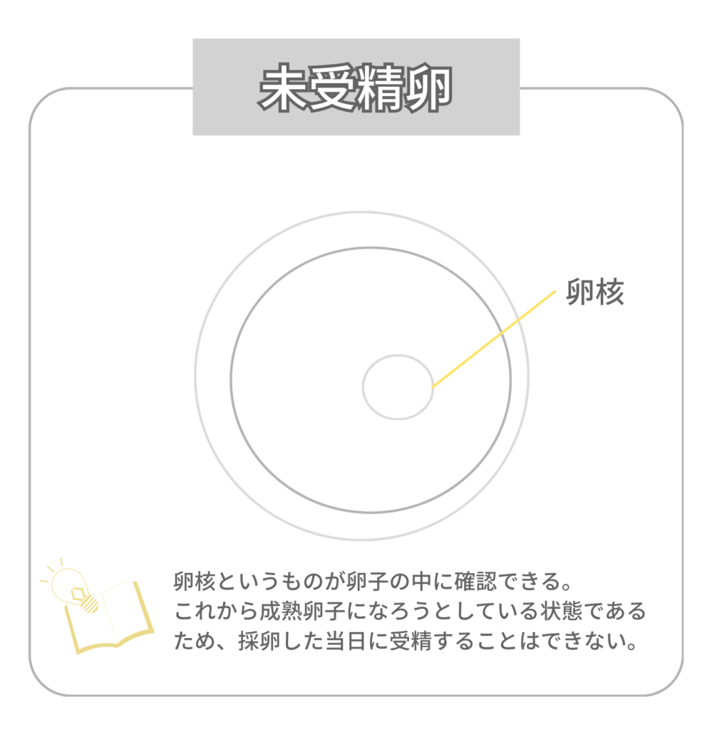 未受精卵の図解