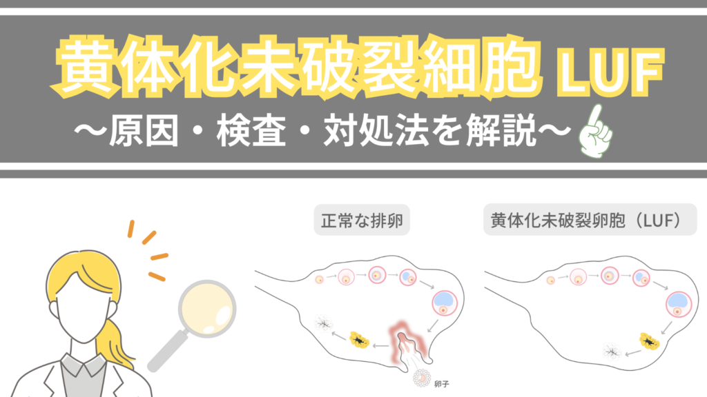黄体化未破裂卵胞(LUF)~医師は気にしないって本当?原因・検査・対処法を解説