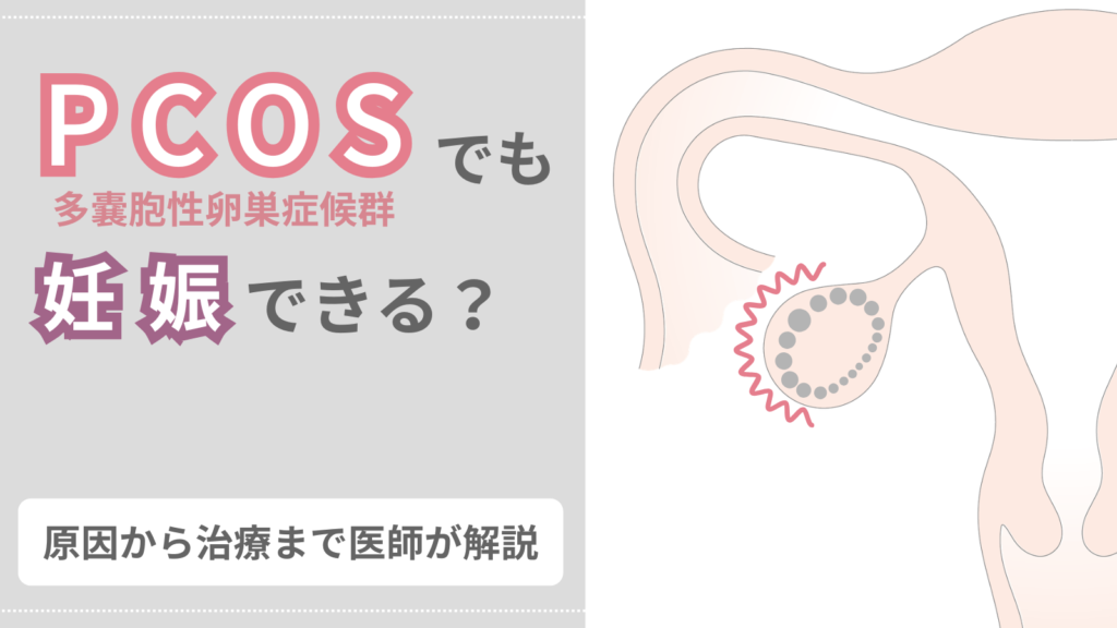 PCOS（多嚢胞性卵巣症候群）でも妊娠できる？原因から治療まで医師が解説