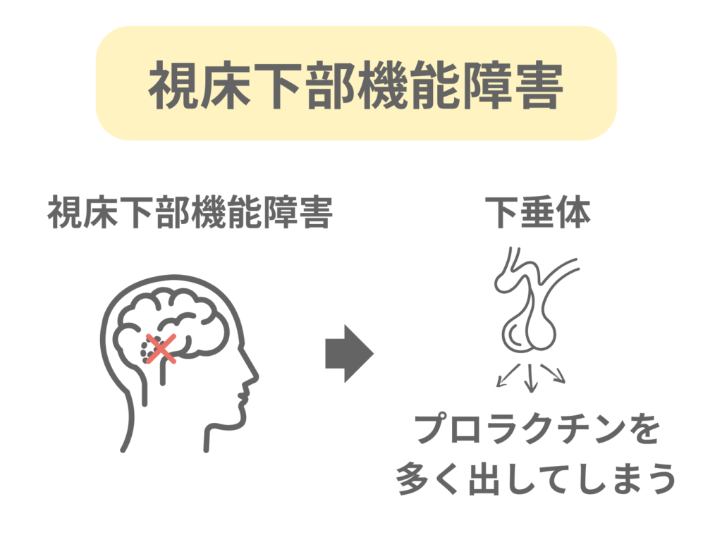視床下部機能障害の図解